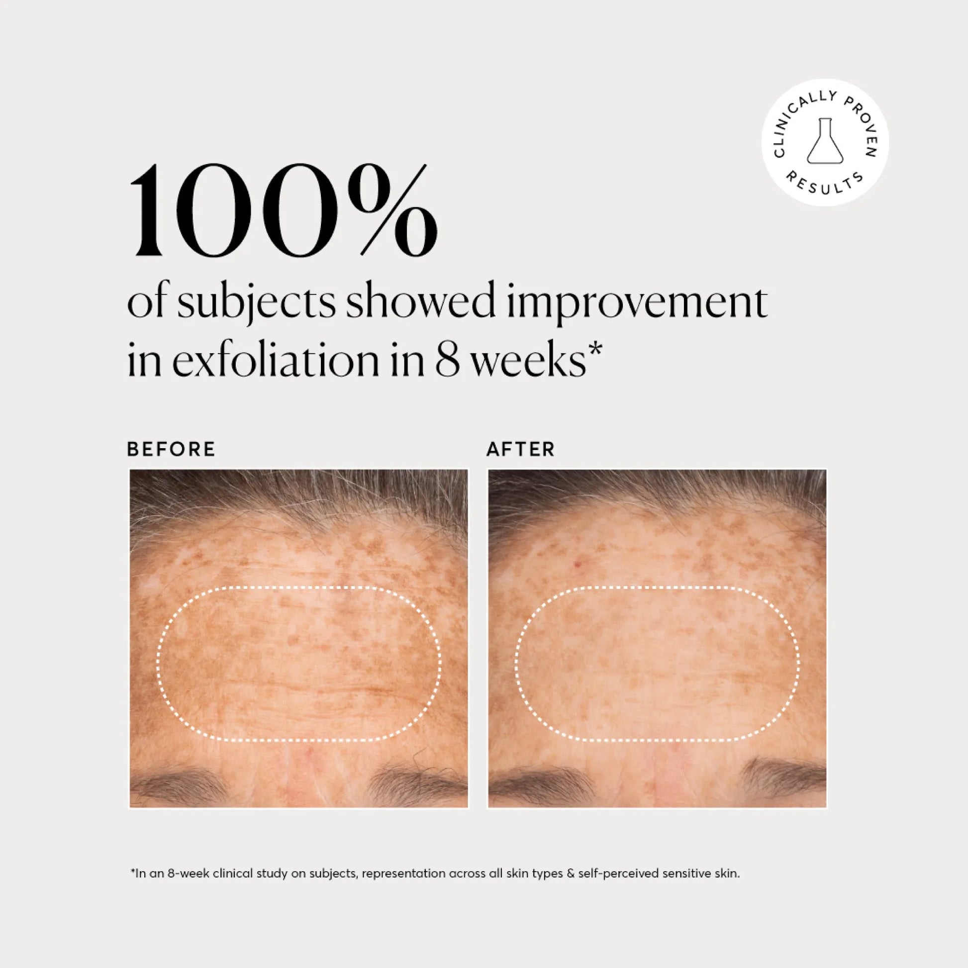 bha-liquid-exfoliant-2-i8 NATR-10027-Alt-Images-BHA-Liquid-Exfoliant-2_-03.webp
