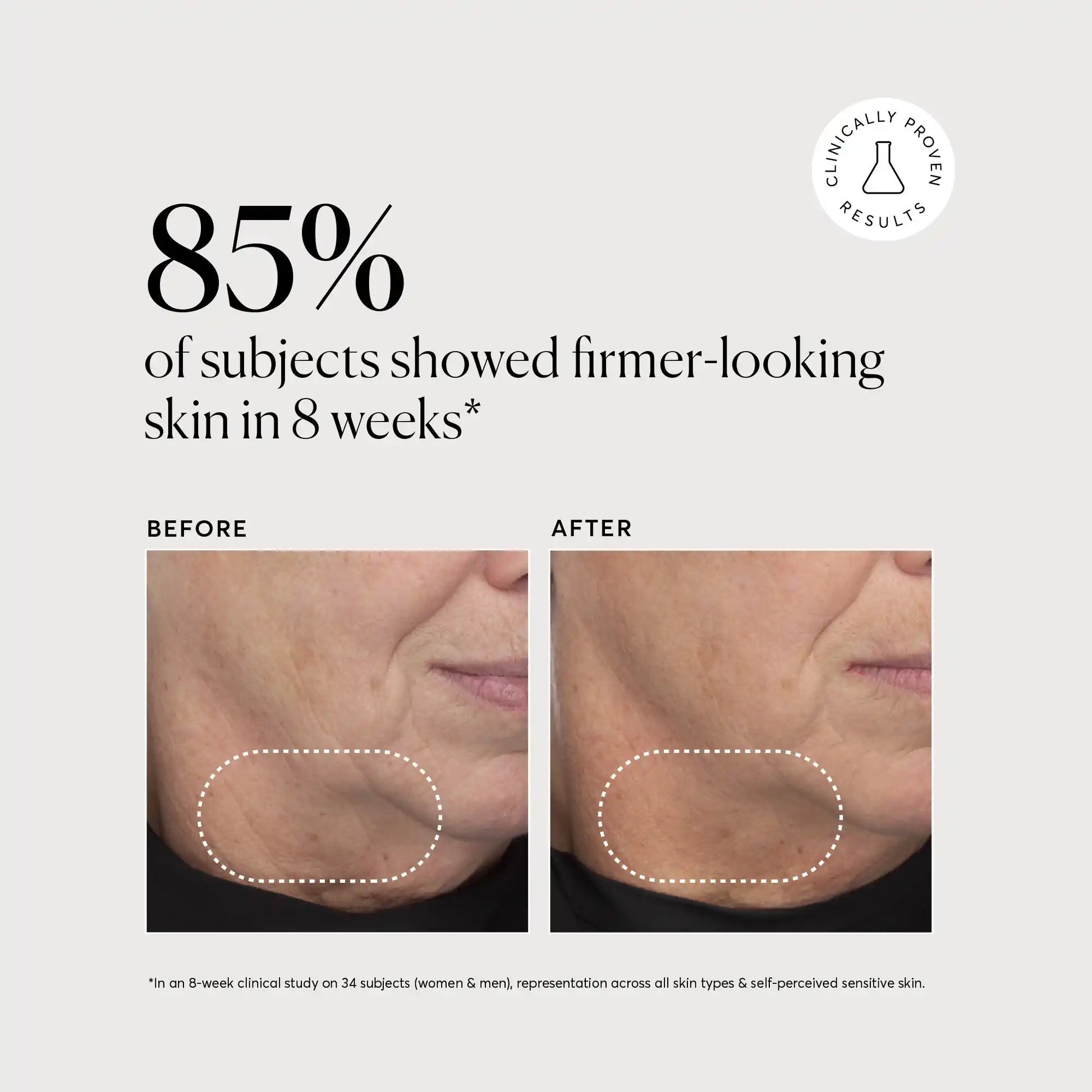 retinol-complex-serum-s2 NATR-10034-Alt-Images-Retinol-Complex-Serum-04.webp